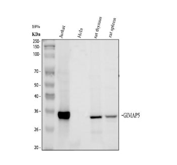 Western blot analysis of GIMAP5 using anti-GIMAP5 antibody. Electrophoresis was performed on a 10% SDS-PAGE gel at 80V (Stacking gel) / 120V (Resolving gel) for 2 hours. Lane 1: human Jurkat whole cell lysates, Lane 2: human HeLa whole cell lysates, Lane 3: rat thymus whole cell lysates and Lane 4: rat spleen whole cell lysates. After electrophoresis, proteins were transferred to a nitrocellulose membrane at 150 mA for 50-90 min. Blocked the membrane with 5% non-fat milk/TBS for 1.5 hour at RT.