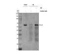 Immunoprecipitating POLM in 293T whole cell lysate. Western blot analysis of POLM using anti-POLM antibody. Lane 1: 293T whole cell lysates (30ug), Lane 2: Rabbit control IgG instead of anti-POLM antibody in 293T whole cell lysate, Lane 3: anti-POLM antibody (2ug) + 293T whole cell lysate (500ug). After electrophoresis, proteins were transferred to a membrane.