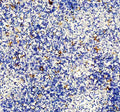 IHC staining of FFPE human spleen tissue with DC-SIGN antibody, HRP-secondary and DAB substrate. HIER: boil tissue sections in pH8 EDTA for 20 min and allow to cool before testing.
