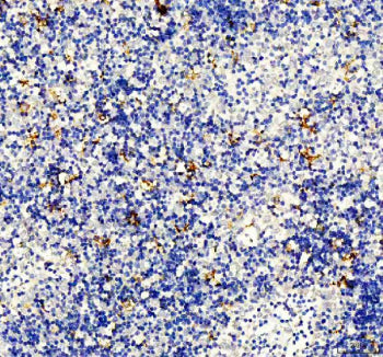 IHC staining of FFPE human spleen tissue with DC-SIGN antibody, HRP-secondary and DAB substrate. HIER: boil tissue sections in pH8 EDTA for 20 min and allow to cool before testing.
