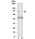 Western blot testing of human placenta lysate with USP6 antibody at 2ug/ml with [B] and without [A] blocking/immunizing peptide. Predicted/observed molecular weight: ~90kDa.