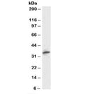 Western blot testing of human kidney lysate and PSMF1 antibody at 1ug/ml. Predicted molecular weight: ~30kDa.