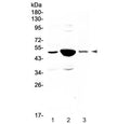 Western blot testing of 1) rat small intestine, 2) rat kidney and 3) mouse kidney lysate with Pai-1 antibody at 0.5ug/ml. Predicted molecular weight ~45 kDa.