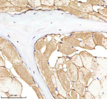 IHC staining of zebrafish Nploc4 protein using Zebrafish Nploc4 antibody, HRP-labeled secondary and DAB substrate. Nploc4 was detected in a paraffin-embedded section of zebrafish muscle tissue. HIER: boil tissue sections in pH8 EDTA for 20 min and allow to cool before testing.
