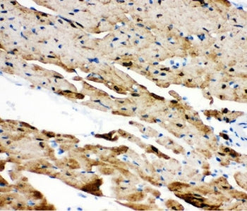 IHC staining of FFPE mouse heart tissue with PLN antibody. HIER: boil tissue sections in pH8 EDTA for 20 min and allow to cool before testing.