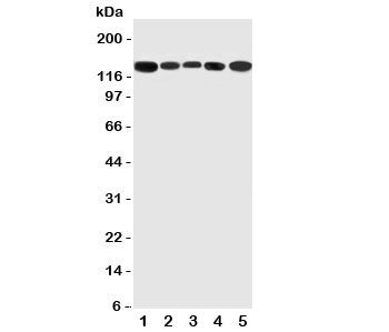 Western blot testing of RGS3 antibody and Lane 1: rat testis; 2: (r) brain; 3: (r) spleen; 4: human HeLa; 5: (h) U87 cell lysate