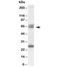 Western blot testing of human brain lysate with GAD65 antibody at 0.1ug/ml. The expected ~65kDa band and the additional ~26kDa band are both blocked by the immunizing peptide.