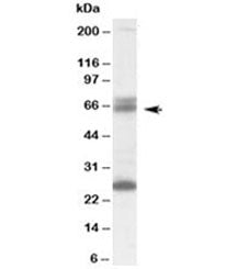 Western blot testing of human brain lysate with GAD65 antibody at 0.1ug/ml. The expected ~65kDa band and the additional ~26kDa band are both blocked by the immunizing peptide.