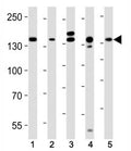 Western blot analysis of lysate from (1) HeLa, (2) MCF-7, (3) mouse C2C12, (4) mouse NIH3T3, (5) rat C6 cell line using Raptor antibody at 1:1000. Predicted molecular weight ~ 149 kDa.