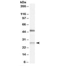Western blot testing of human kidney lysate with BNIP1 antibody at 0.5ug/ml. Predicted molecular weight: ~26kDa. Both bands are both blocked by the immunizing peptide.
