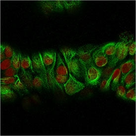 Immunofluorescent staining of MeOH-fixed human MCF7 cells with recombinant Basic Cytokeratin antibody (green, clone KRT18/834) and Reddot nuclear stain (red).