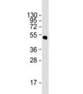 Western blot testing of 12 tag recombinant protein lysate with HSV tag antibody at 1:2000.