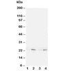 Western blot testing of HMGB4 antibody and Lane 1: rat brain; 2: rat testis; 3: (h) Jurkat; 4: (h) HT1080 cell lysate