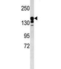 ABCC9 antibody western blot analysis in mouse kidney tissue lysate. Predicted molecular weight ~174 kDa.