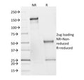 SDS-PAGE analysis of purified, BSA-free SDHB antibody (clone SDHB/2382) as confirmation of integrity and purity.