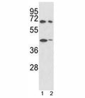 Western blot analysis of SHP2 antibody and 1) 293, 2) K562 lysate. Predicted molecular weight: ~68kDa.