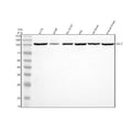 Western blot analysis of GALC using anti-GALC antibody. Electrophoresis was performed on a 10% SDS-PAGE gel at 80V (Stacking gel) / 120V (Resolving gel) for 2 hours. Lane 1: human whole cell lysates, Lane 2: human whole cell lysates, Lane 3: human SH-SY5Y whole cell lysates, Lane 4: human HEL whole cell lysates, Lane 5: rat brain tissue lysates, Lane 6: mouse brain tissue lysates. After electrophoresis, proteins were transferred to a nitrocellulose membrane at 150 mA for 50-90 min.