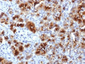IHC testing of FFPE human pancreas with GP2 antibody (clone GP2/1712). HIER: boil tissue sections in 10mM Tris with 1mM EDTA, pH 9, for 10-20 min.