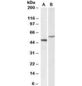 Western blot testing of human hippocampus [A] and HeLa [B] lysates with CD47 antibody at 0.3ug/ml. Predicted molecular weight: 35~60 kDa depending on glycosylation level.