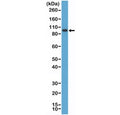Western blot testing of human K562 cell lysate with recombinant SATB2 antibody at 1:1000 dilution. Predicted molecular weight ~83 kDa.
