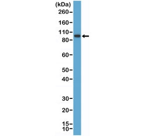 Western blot testing of human K562 cell lysate with recombinant SATB2 antibody at 1:1000 dilution. Predicted molecular weight ~83 kDa.