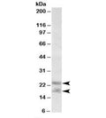 Western blot testing of human prostate lysate with IL-25 antibody at 0.3ug/ml. Predicted molecular weight: ~18 kDa (unmodified), 21-26 kDa (glycosylated).