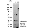 SDS-PAGE analysis of purified, BSA-free recombinant CD63 antibody (clone LAMP3/9191R) as confirmation of integrity and purity.