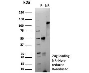 SDS-PAGE analysis of purified, BSA-free recombinant CD63 antibody (clone LAMP3/9191R) as confirmation of integrity and purity.