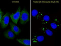 Fluorescent image of U251 cells stained with anti-ATG5 antibody diluted at 1:25 dilution. U251 cells were treated with Chloroquine (50 uM, 16h), An Alexa Fluor 488-conjugated goat anti-rabbit lgG was used as the secondary Ab (green). DAPI was used as a nuclear counterstain (blue).