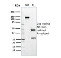 SDS-PAGE analysis of purified, BSA-free SREBP2 antibody (clone SREBP2/1579) as confirmation of integrity and purity.