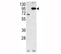 Western blot analysis of Amyloid beta antibody and 293 cell lysate either nontransfected (Lane 1) or transiently transfected with the APP gene (2). Predicted molecular weight 79~120kDa depending on glycosylation level.