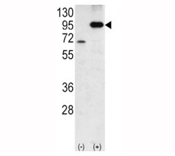 Western blot analysis of Amyloid beta antibody and 293 cell lysate either nontransfected (Lane 1) or transiently transfected with the APP gene (2). Predicted molecular weight 79~120kDa depending on glycosylation level.