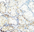 IHC staining of FFPE human teratoma tissue with CD24 antibody, HRP-labeled secondary and DAB substrate. HIER: boil tissue sections in pH8 EDTA for 20 min and allow to cool before testing.