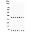 Western blot testing of LIF antibody and Lane 1: rat intestine; 2: (r) brain; 3: (r) spleen; 4: (r) thymus; 5: mouse brain; 6: (m) kidney; 7: (m) liver. The 180 amino acid protein is heavily glycosylated and is routinely visualized from 32~62 KD.