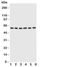 Western blot testing of SCYL antbody on Lane 1: U87; 2: HeLa; 3: 293T; 4: MCF-7; 5: COLO320; 6: HE1080 cell lysate