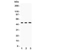 Western blot testing of GATA3 antibody and Lane 1: rat brain; 2: human MCF-7; 3: (h) HEPG2. Predicted molecular weight: 50 kDa