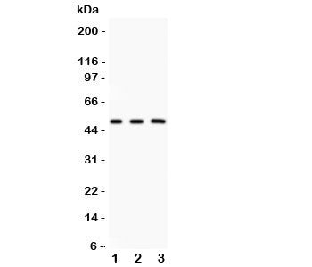 Western blot testing of GATA3 antibody and Lane 1: rat brain; 2: human MCF-7; 3: (h) HEPG2. Predicted molecular weight: 50 kDa