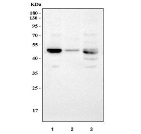 Western blot testing of 1) rat liver, 2) rat lung and 3) mouse liver tissue lysate with LOX antibody. Expected molecular weight: ~47 kDa (unprocessed/unmodified), ~50 kDa (glycosylated), ~32 kDa (processed form).