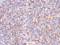 IHC staining of FFPE human tonsil tissue with Succinate dehydrogenase B antibody (clone SDHB/3204). HIER: boil tissue sections in pH 9 10mM Tris with 1mM EDTA for 20 min and allow to cool before testing.