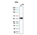 Western blot testing of human lung tissue lysate with Alpha 1 Antitrypsin antibody. Expected molecular weight: 47-52 kDa depending on the level of glycosylation.