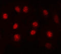 Immunofluorescent staining of FFPE human A549 cells with MAX antibody (red). HIER: steam section in pH6 citrate buffer for 20 min.