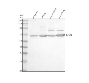 Western blot analysis of SLFN12 using anti-SLFN12 antibody. Electrophoresis was performed on a 10% SDS-PAGE gel at 80V (Stacking gel) / 120V (Resolving gel) for 2 hours. Lane 1: rat spleen tissue lysates, Lane 2: rat lung tissue lysates, Lane 3: mouse spleen tissue lysates, Lane 4: mouse lung tissue lysates. After electrophoresis, proteins were transferred to a nitrocellulose membrane at 150 mA for 50-90 min. Blocked the membrane with 5% non-fat milk/TBS for 1.5 hour at RT.