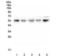Western blot testing of human 1) U-2 OS, 2) PC-3, 3) U-87 MG, 4) A549 and 5) HeLa cell lysate with RBMS3 antibody. Expected molecular weight: 48-55 kDa.
