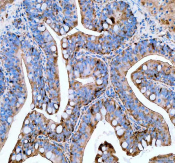 IHC staining of FFPE zebrafish colon tissue with Zebrafish Psmc4 antibody, HRP secondary and DAB substrate. HIER: boil tissue sections in pH8 EDTA for 20 min and allow to cool before testing.