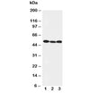 Western blot testing of Beclin 1 antibody and Lane 1: HeLa; 2: SW620; 3: PANC cell lysate. Predicted and Observed size: 49KD