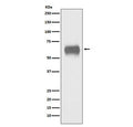 Western blot testing of human plasma lysate with CD5 antibody. Observed molecular weight: 55~67 kDa depending on glycosylation level.