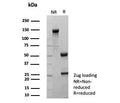 SDS-PAGE analysis of purified, BSA-free recombinant TFF1 antibody (clone rTFF1/9134) as confirmation of integrity and purity.