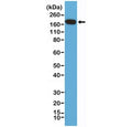 Western blot of human HeLa cell lysate using recombinant EGFR antibody at a 1:200 dilution. Expected molecular weight: 134-180 kDa depending on glycosylation level.
