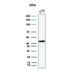 Western blot analysis of Human Brain, Mouse Brain, Rat Brain, Hamster Brain, Guinea pig Brain, Human Stomach, Mouse Stomach, Rat Stomach, Hamster Stomach and Guinea pig Stomach tissue lysates using recombinant CKBB antibody (clone rCKBB/8842). Predicted molecular weight ~43 kDa.