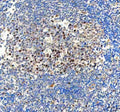 IHC staining of FFPE human tonsil tissue with BAG1 antibody. HIER: boil tissue sections in pH8 EDTA for 20 min and allow to cool before testing.